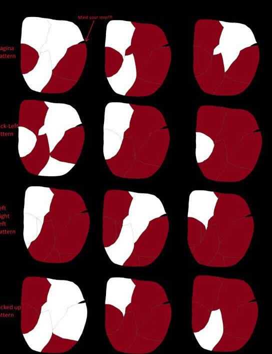 ������M���ˣ����ؽ׶���Ѫ�򷨼�ʱ����